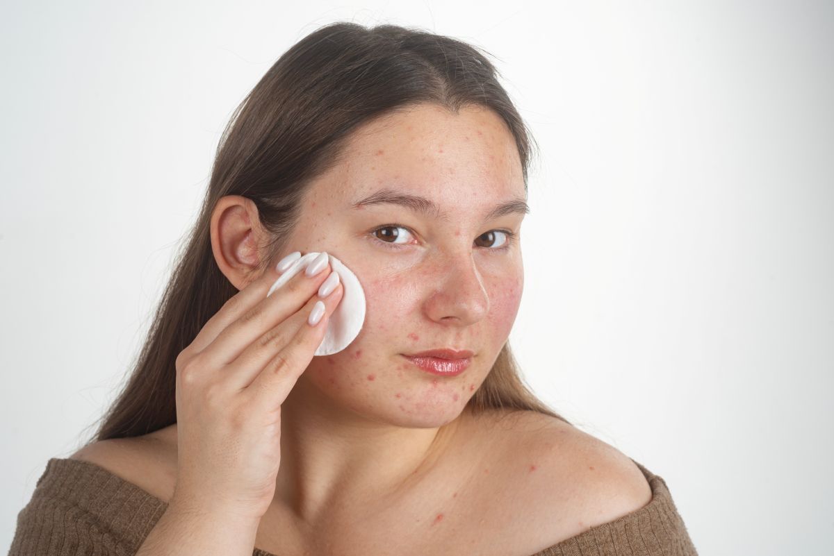 ¿Cómo ayuda el aloe vera al cuidado de las pieles con tendencia a la foliculitis?